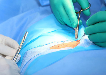 Лечение грыжи позвоночника без операции в израиле thumbnail